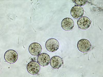 Crédito: Genome Research Limited / Divulgação. Imagem de um processo de fertilização in vitro.